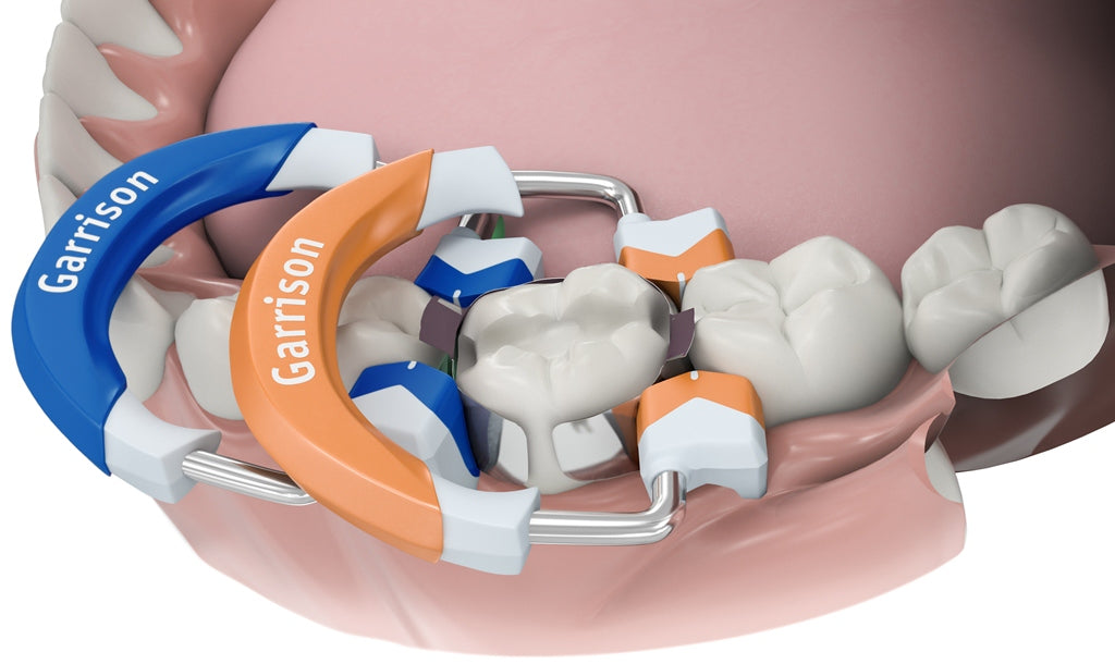 Garrison Ring Composi Tight 3D Fusion Matrix Rings 2/Pack