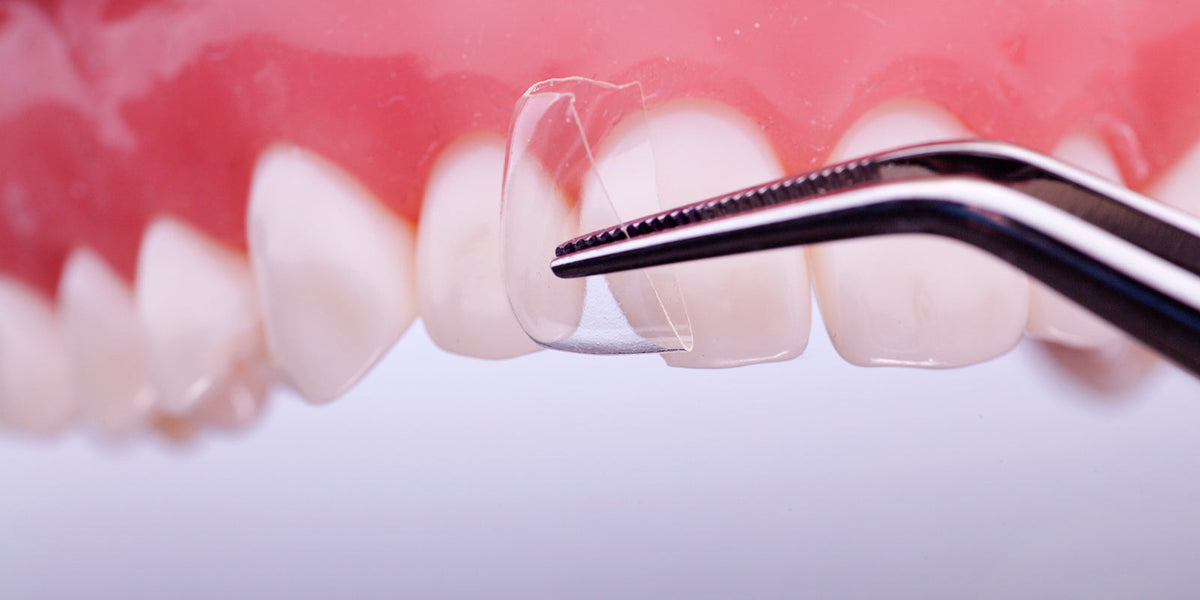 Directa, CoForm Celluloid Crowns for Class IV