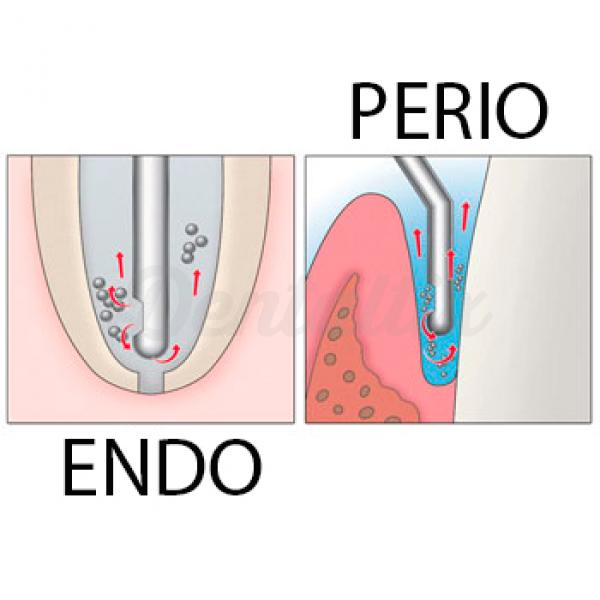 Endo Irrigation Syringes 100/Box