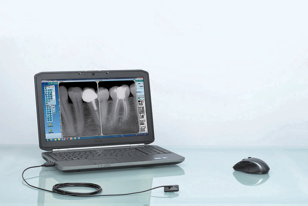Owandy- OPTEO IntraOral Digital XRay Sensor Size #1&amp;#2